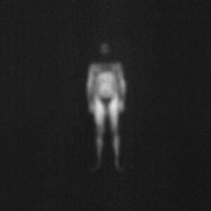 piel - IOSONOUNCANE