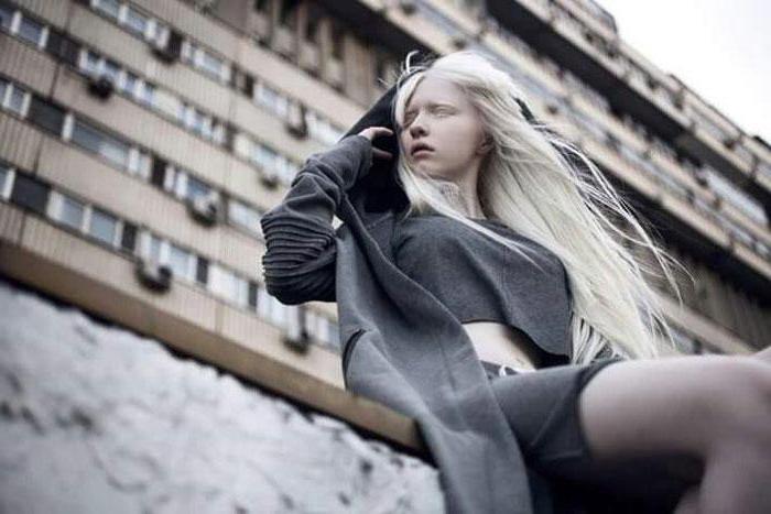 Настя Жидкова: модель-альбинос с нестандартной внешностью 