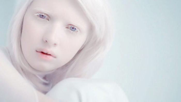 Настя Жидкова: модель-альбинос с нестандартной внешностью 